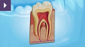 Healthy Gums Liverpool